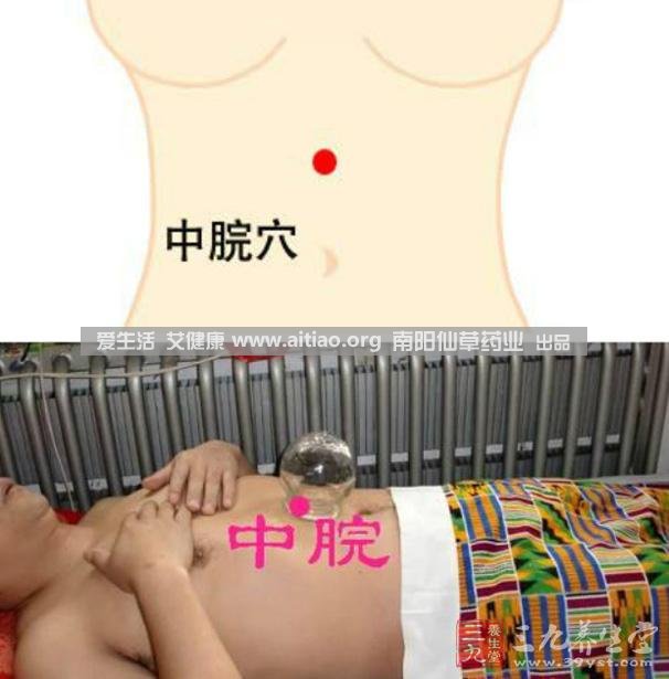 中脘穴位于腹部正中線(xiàn)，臍上4寸的位置上。每天艾灸10-15分鐘，能有效緩解胃部不適的癥狀，同時(shí)有助于祛濕。